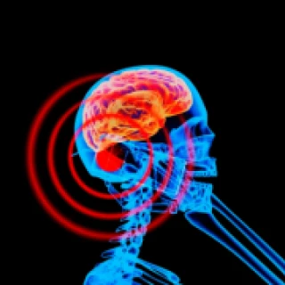 El uso intensivo de teléfonos móviles aumentaría el riesgo de cáncer cerebral, sugieren un nuevo estudio